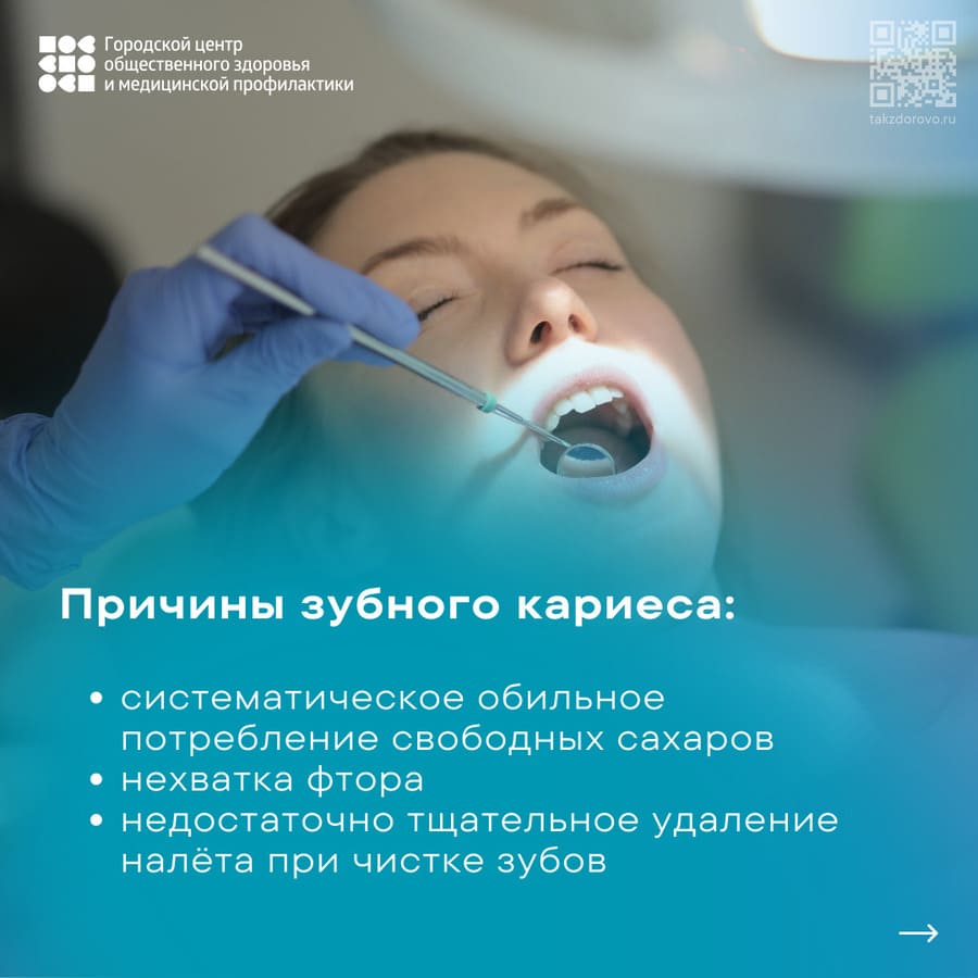 Причины зубного кариеса